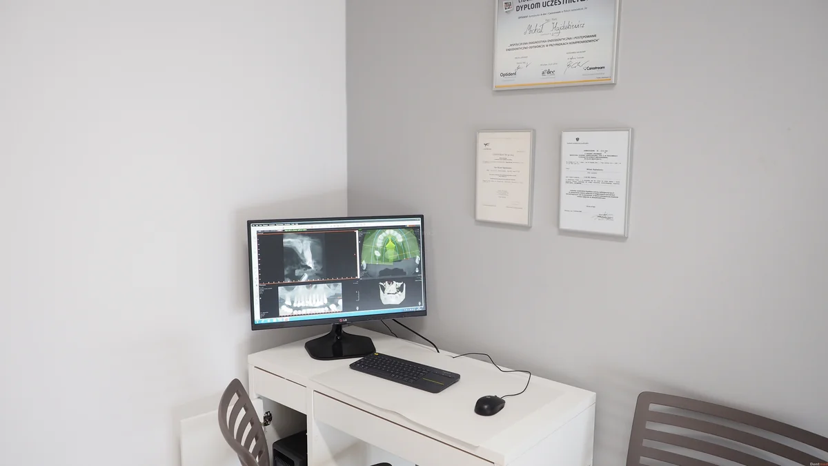 Stanowisko komputerowe pracowni RTG z obrazem diagnostycznym na monitorze